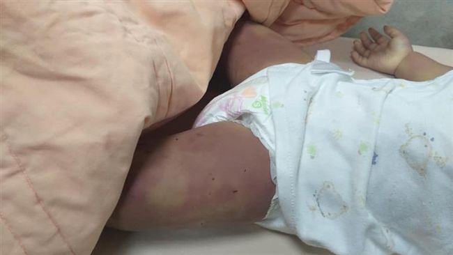 抓到了！重大兒虐過半是「他們」施暴