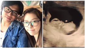 阿弟,Mei,蕭景鴻,懷孕,小產/阿弟臉書