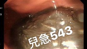 食道,糖炒栗子,躺著吃,噎到,堅果（圖／翻攝自《來講兒科急診的543-吳昌騰醫師》臉書）