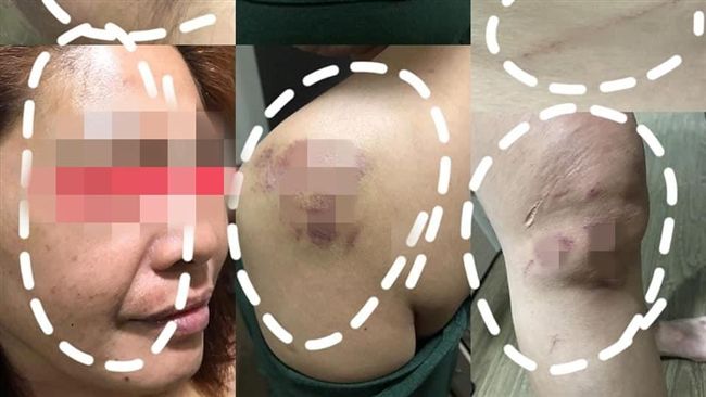 狠男打妻虐子家暴成性　再爆虐現女友