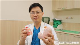 醫師羅文鍵說明腹腔鏡胃縮小手術術程。（圖／亞大醫院提供）