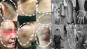 毀妻容、踹斷6歲兒肋骨！夫竟囂張嗆：打孩子剛好而已啦
爆料公社