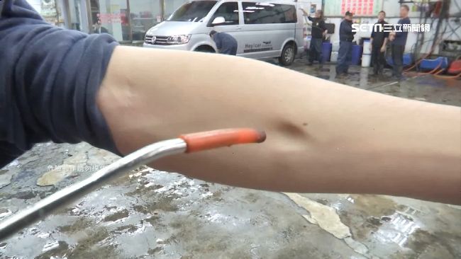 桃園男尿尿被噴槍射屁股　悲慘下場曝光
