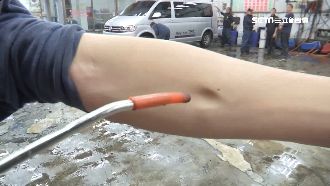 女童慘遭噴槍奪命！氣體栓塞是什麼？