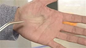 風槍,女童,高大成,死因