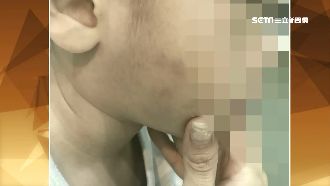 背不出九九乘法！3歲童遭師捏臉施暴