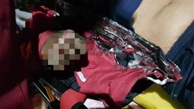 苗栗,電擊,釣竿,高壓電線,皮開肉綻（圖／翻攝畫面）