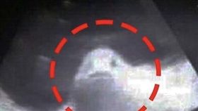 菲律賓,超音波（圖／翻攝自推特）