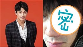 威廉眼睛遭木劍打傷爆血/翻攝自臉書