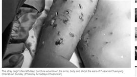 渡假勝地變調！男童普吉島海邊嬉戲　慘遭4流浪狗咬成重傷　圖／翻攝曼谷郵報