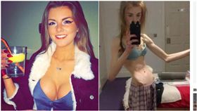 英國,厭食症,爆乳,巧克力,瘦弱（圖／翻攝自annie100101 IG）