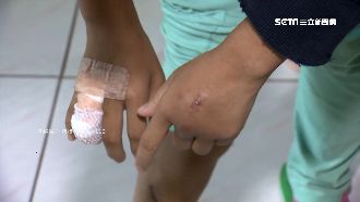 持鐵鎚打女友　恐怖情人反控她太花心