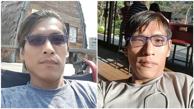 盛名害遺棄　連體嬰忠仁：死也難回家