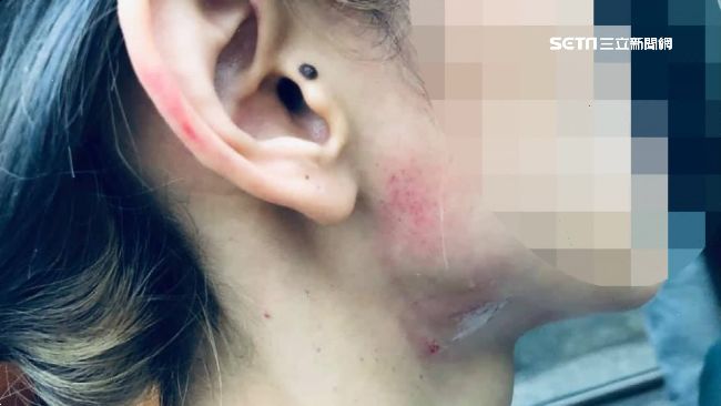 控遭分居夫勒脖拔髮　女泣：求助無門