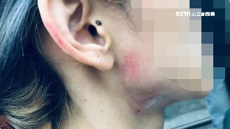 控遭分居夫勒脖拔髮　女泣：求助無門