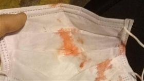 ▲少女扮奇寶恐龍挨揍，留了許多鼻血，「覺得鼻樑快斷了」。（圖／翻攝自臉書奇寶恐龍來了）