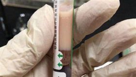 花生瓜子,堅果,血糖,血脂,