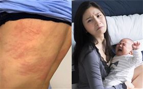 港星林芊妤/風濕/內分泌失調。IG