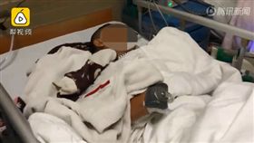 危險炮竹少碰！男子玩「魚雷」手中自爆　手掌炸飛小腸炸爛（圖／翻攝自騰訊視頻）