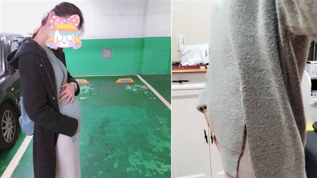 便秘5天解放！她凸肚消風…照片驚呆
