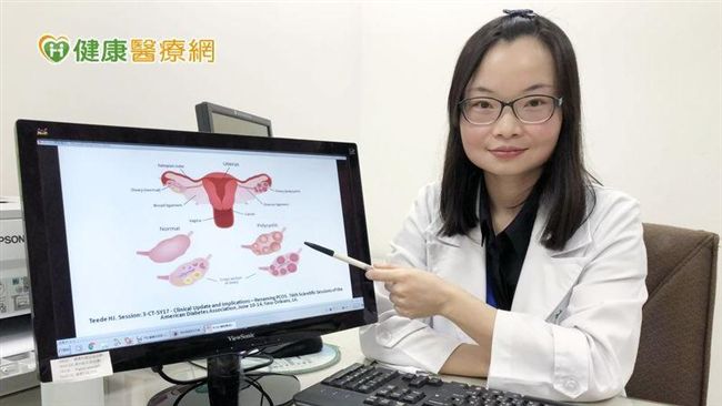 經期不順滿臉痘？　小心多囊性卵巢症