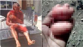 夫找女鄰居當小三，遭正宮砍爆生殖器「取蛋」。（圖／翻攝自微博）