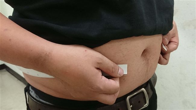 中年男性若有貧血問題　恐是癌症纏身