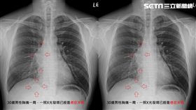 30歲勞工被診斷癌末　他第一句話讓醫師心痛(圖/蘇一峰醫師授權提供)