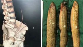 泥鰍塞肛門／微博