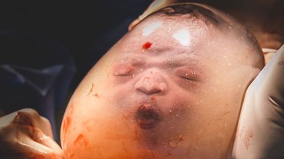 驚人！嬰兒「還在羊水內嘟嘴」就出生
