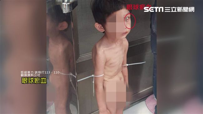 幼童遭綁陽台凌虐40小時　生父推責