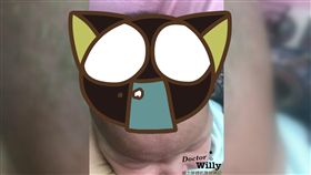 頭,嬰兒,皮屑,鱗片,寶寶,青春痘,皮膚,醫師,清潔,　圖／翻攝自翻攝自臉書威力醫師的育兒週記　https://goo.gl/Cn7dsq