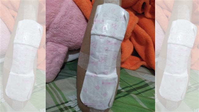 他曬女友超狂包紮法　網讚：可以娶了
