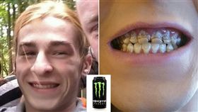 英國,能量飲料,男大生,牙齒,提神飲料
https://pbs.twimg.com/media/DzbAFYMWoAAaTD9.jpg