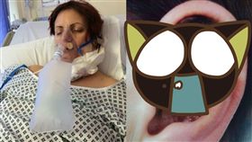 英國,皮膚癌,日曬機,皮膚,膚色,疣,肉瘤,潰爛,發黑 圖／翻攝自Whitworth Hats FB