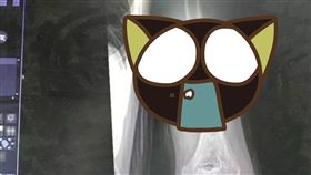 骨折,螺旋型,大陸,江蘇,罕見,比腕力,力氣,急診,扭斷　圖／翻攝自微博　