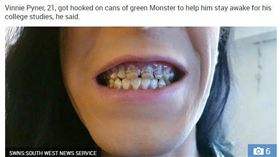 一天6罐能量飲提神　21歲帥哥整口牙爛光／the sun