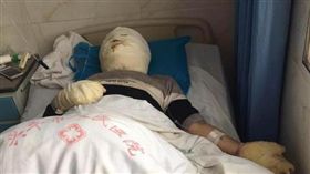 男帶氫氣球搭電梯圖爆炸，6人慘遭嚴重燒傷送醫。（圖／翻攝新浪網）