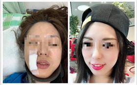 成大操場慢跑遭毆打　翻攝臉書