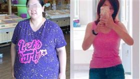 圖／中國附醫整形外科醫師陳彥州提供,贅皮布袋奶