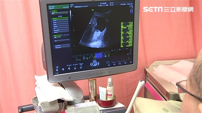 罕病兒4歲病逝　她再懷孕結果心碎了