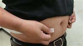 長庚研究：內臟脂肪愈多得慢性腎病風險增林口長庚紀念醫院研究發現，內臟脂肪指數（VAI）愈高的人，血壓、血脂、空腹血糖愈高，腎功能也愈差，罹患慢性腎臟病風險高出1.5倍。圖為肥胖示意。（長庚醫院提供）中央社記者陳偉婷傳真　107年12月30日