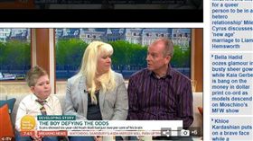 腦殘缺,母親,奇蹟,英國　圖／每日郵報
