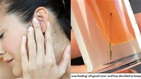 女子耳朵痛求診 醫生檢查一看驚呆：裡面長草了！（圖／Daily Mail,每日日報）