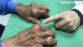 烏日林新醫院,過敏免疫風濕科,林剛民,尿酸,關節,痛風
圖／烏日林新醫院提供