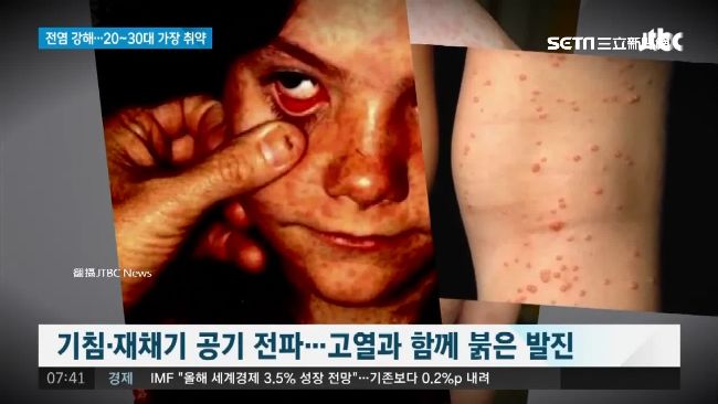 連假出國注意！這5國家都爆麻疹疫情