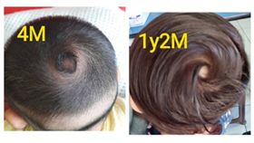 女嬰後腦杓的颱風眼　網驚呼：風神投胎吧！（圖／爆廢公社）