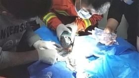 鐵環,滾珠,生殖器,陰莖,套筒,卡住,陰莖,刺激, 圖／翻攝自微博