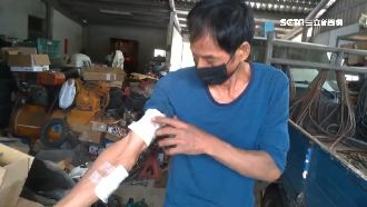 輪胎打氣竟爆炸！修車師傅遭炸傷