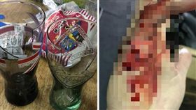 玻璃杯，割傷，麥當勞，世界盃